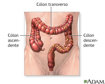 Ressecção do intestino grosso - série