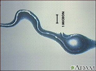 Organismo da doença de Lyme - Borrelia burgdorferi