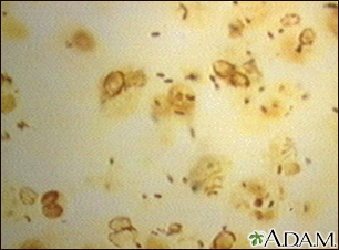 Organismo da doença dos legionários, legionella