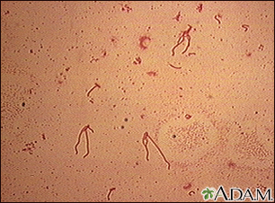 Organismo Yersinia enterocolitica