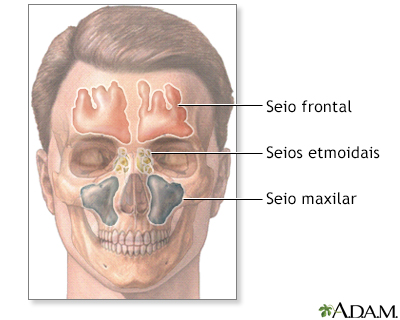 Seios nasais