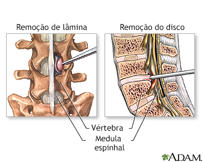 Procedimento