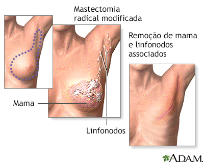 Procedimento 2