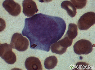 Mononucleose, fotomicrografia das células