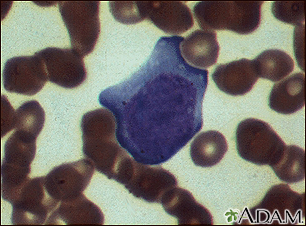 Mononucleose, fotomicrografia de células