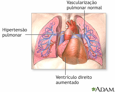 Indicações