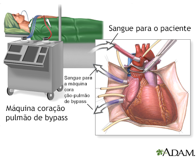 Procedimento, parte 1