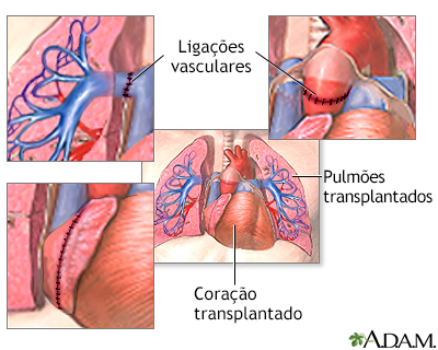 Procedimento, parte 2