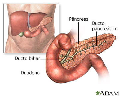 Pancreatite - série