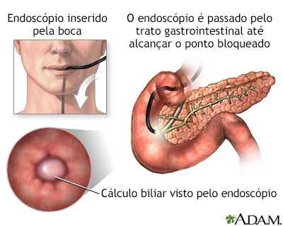 Procedimento