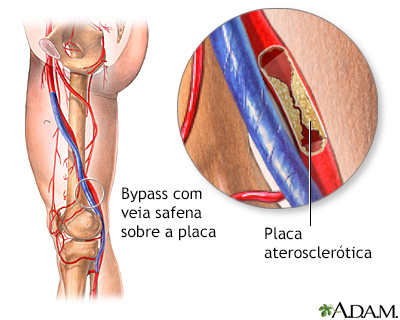 Procedimento