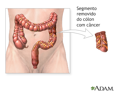 Procedimento