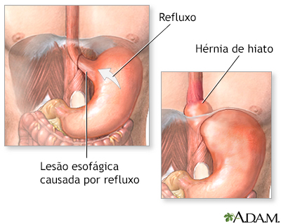 Indicação