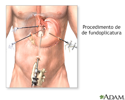 Procedimento, parte 1