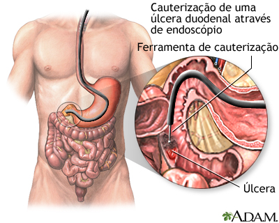 Procedimento, parte 2