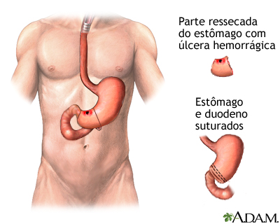 Procedimento, parte 3