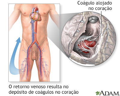 Procedimento, parte 1