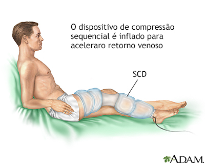 Cuidado após o procedimento