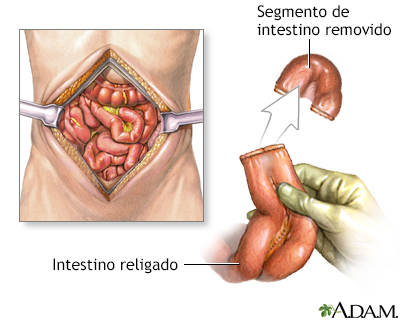 Procedimento