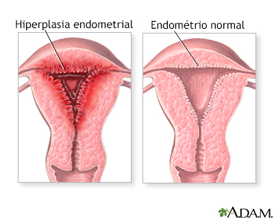 Ciclos menstruais anormais