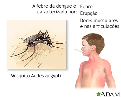 Dengue