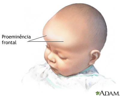 Protuberância frontal