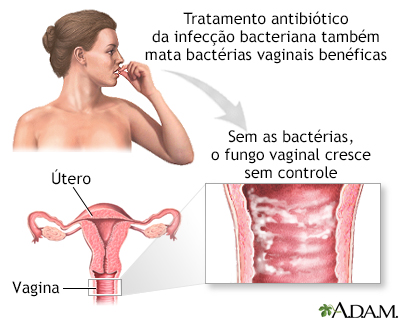 Infecção secundária