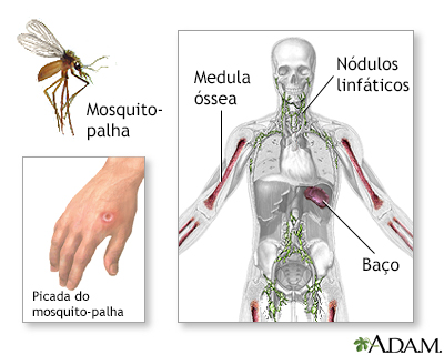 Leishmaniasis