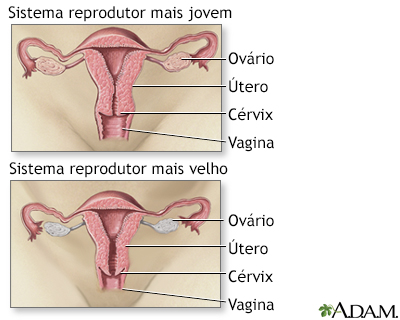 Menopausa