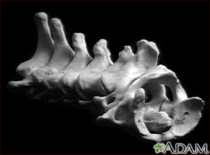 Vértebra, cervical (pescoço)