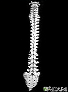 Coluna vertebral