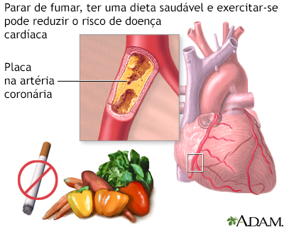 Prevenção de doença cardíaca