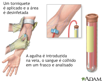 Exame de sangue PSA