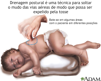 Drenagem postural