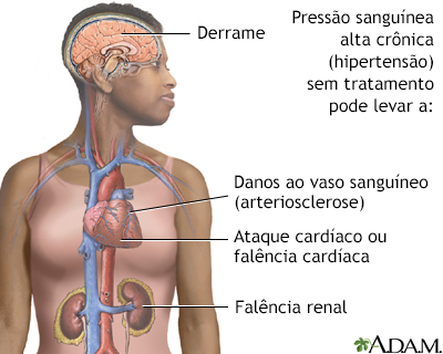 Hipertensão não tratada