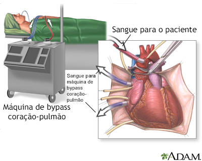 Procedimento, parte 1