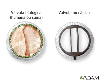 Procedimento, parte 2