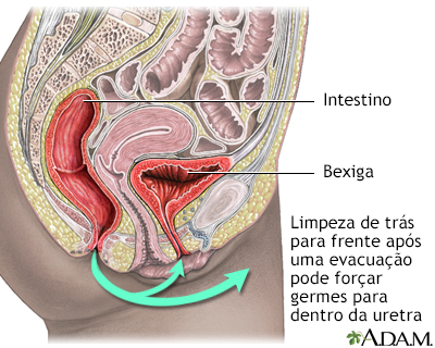 Prevenção da cistite