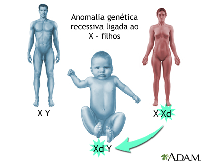 Anomalias genéticas recessivas ligadas ao X - como os meninos são afetados