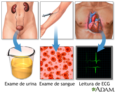 Exames de hipertensão