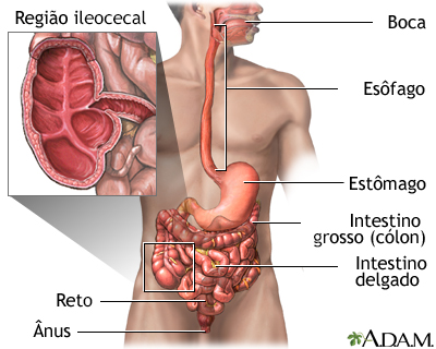 Doença de Crohn - áreas afetadas