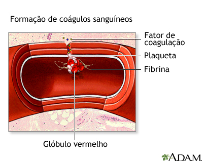 Formação de coágulo