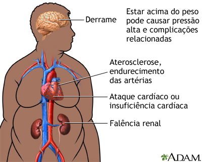 Obesidade e saúde