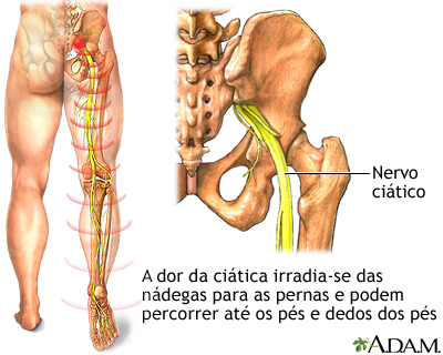 Nervo ciático