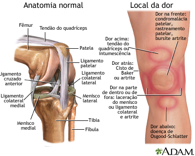 Dor no joelho