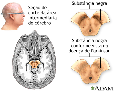 Substância negra e mal de Parkinson