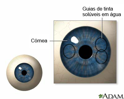 Procedimento, parte 1