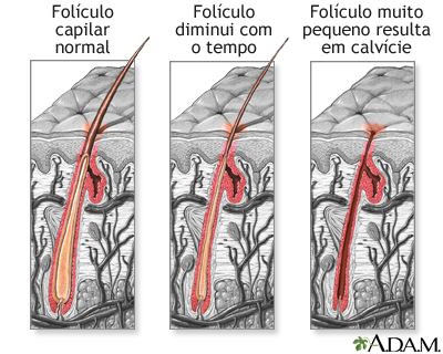 Folículo capilar