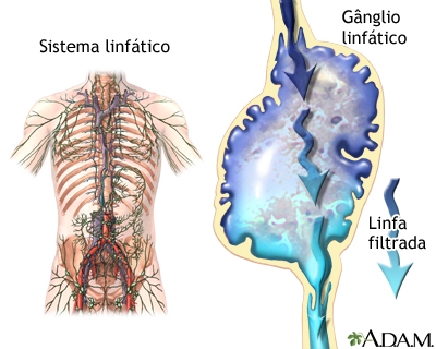 Sistema linfático