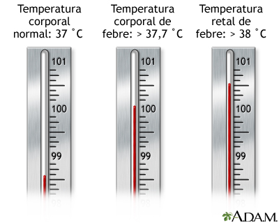 Termômetro - temperatura